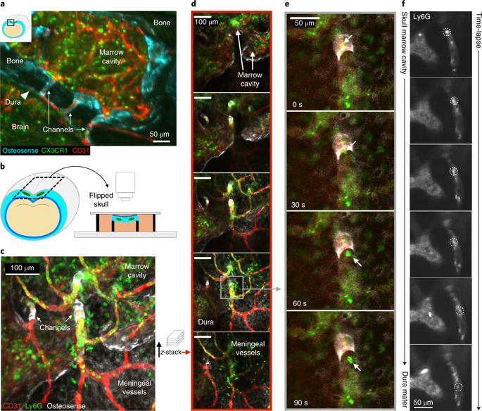 Ex_vivo_confocal_microscopy_of_channels_connecting_the_skull_marrow_to_the_dura